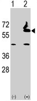 PAB2090 - Alpha-L-fucosidase 2 / FUCA2