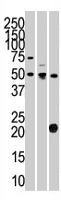 PAB2093 - STYK1 / NOK