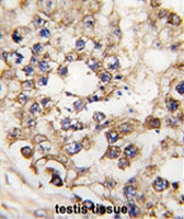 PAB2101 - Insulin promoter factor 1