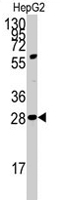 PAB2102 - Insulin promoter factor 1