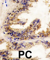 PAB2106 - B-Raf proto-oncogene