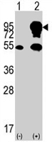 PAB2106 - B-Raf proto-oncogene