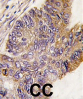 PAB2115 - RPS6KA1