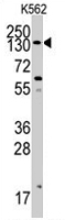 PAB2126 - PIK3CA