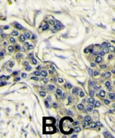 PAB2126 - PIK3CA