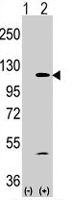 PAB2126 - PIK3CA