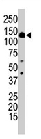PAB2127 - PIK3R4