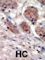 PAB2131 - PI4K2A