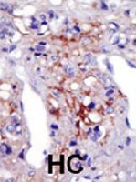 PAB2132 - PIP5K1C