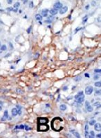 PAB2133 - PIP5K1C