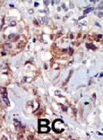 PAB2134 - PIP4K2A / PIP5K2A