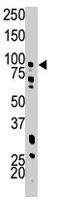 PAB2141 - PFKM