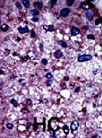 PAB2141 - PFKM