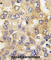 PAB2142 - PFKM