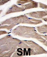 PAB2142 - PFKM