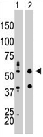 PAB2143 - EIF2AK2 / PKR