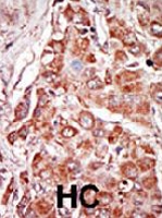 PAB2143 - EIF2AK2 / PKR