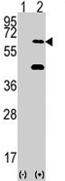 PAB2143 - EIF2AK2 / PKR