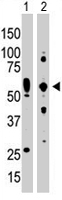 PAB2144 - EIF2AK2 / PKR