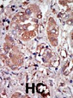 PAB2144 - EIF2AK2 / PKR