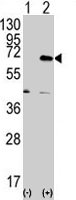 PAB2144 - EIF2AK2 / PKR