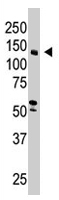 PAB2150 - MAGI1 / BAIAP1