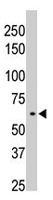 PAB2151 - Protein phosphatase 1D / PPM1D