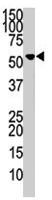 PAB2155 - Protein phosphatase 1F / PPM1F