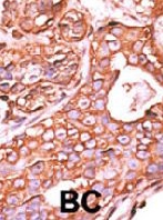 PAB2155 - Protein phosphatase 1F / PPM1F