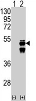 PAB2155 - Protein phosphatase 1F / PPM1F