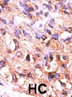 PAB2156 - Protein phosphatase 1F / PPM1F