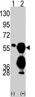 PAB2156 - Protein phosphatase 1F / PPM1F
