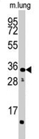 PAB2157 - CTDSP2