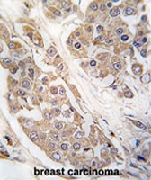 PAB2157 - CTDSP2