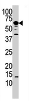 PAB2159 - PPP3CA / Calcineurin A