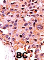 PAB2159 - PPP3CA / Calcineurin A