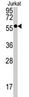 PAB2160 - PPP3CB / CALNA2