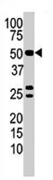 PAB2160 - PPP3CB / CALNA2