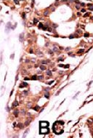 PAB2160 - PPP3CB / CALNA2