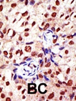 PAB2169 - PRMT2