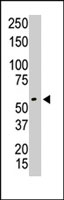 PAB2172 - PRMT3