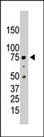 PAB2175 - PRMT5