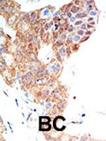 PAB2175 - PRMT5