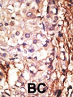 PAB2176 - PRMT6 / HRMT1L6