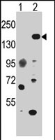 PAB2182 - EHMT1