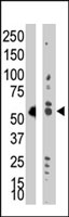 PAB2186 - DNMT2 / TRDMT1
