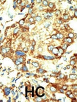 PAB2186 - DNMT2 / TRDMT1