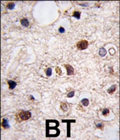 PAB2188 - JMJD3 / KDM6B