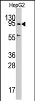 PAB2191 - DNMT3A