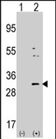 PAB2193 - NNMT